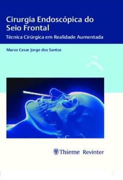 Imagem de CIRURGIA ENDOSCOPICA DO SEIO FRONTAL