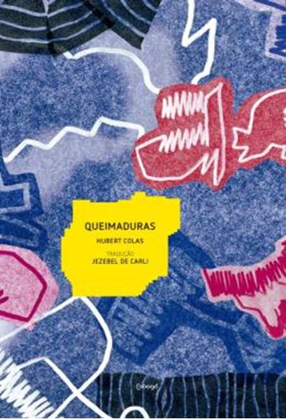 Picture of QUEIMADURAS